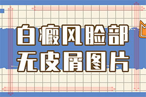 脖子上有白色斑塊是什么原因？白癜風誘發原因做什么檢查-得白癜風的概率